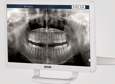 Monitor Barco 22